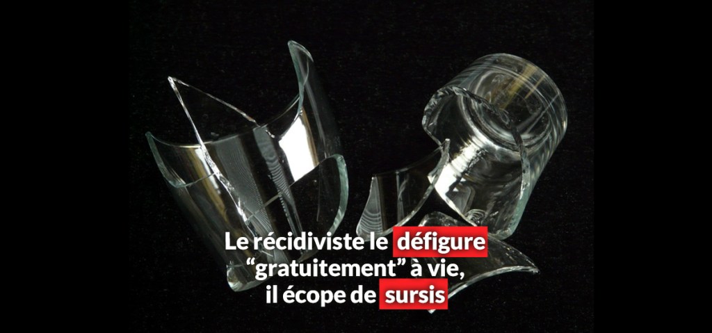 Le récidiviste le défigure “gratuitement” à vie, il écope de&nbsp;sursis