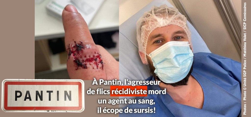 À Pantin, l&rsquo;agresseur de flics récidiviste mord un agent au sang, il écope de&nbsp;sursis!